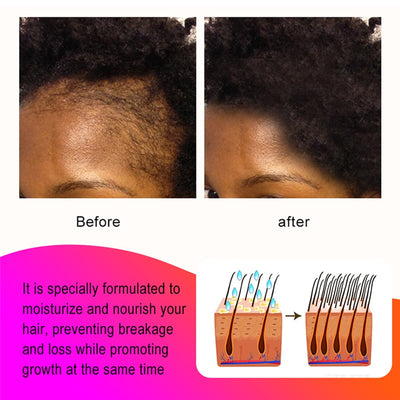 Sevich Nourishing Hair Mask 100g Traction Alopecia Chebe Powder Hair Mask Fast Hair Growth Anti Hair Loss Treatment Products