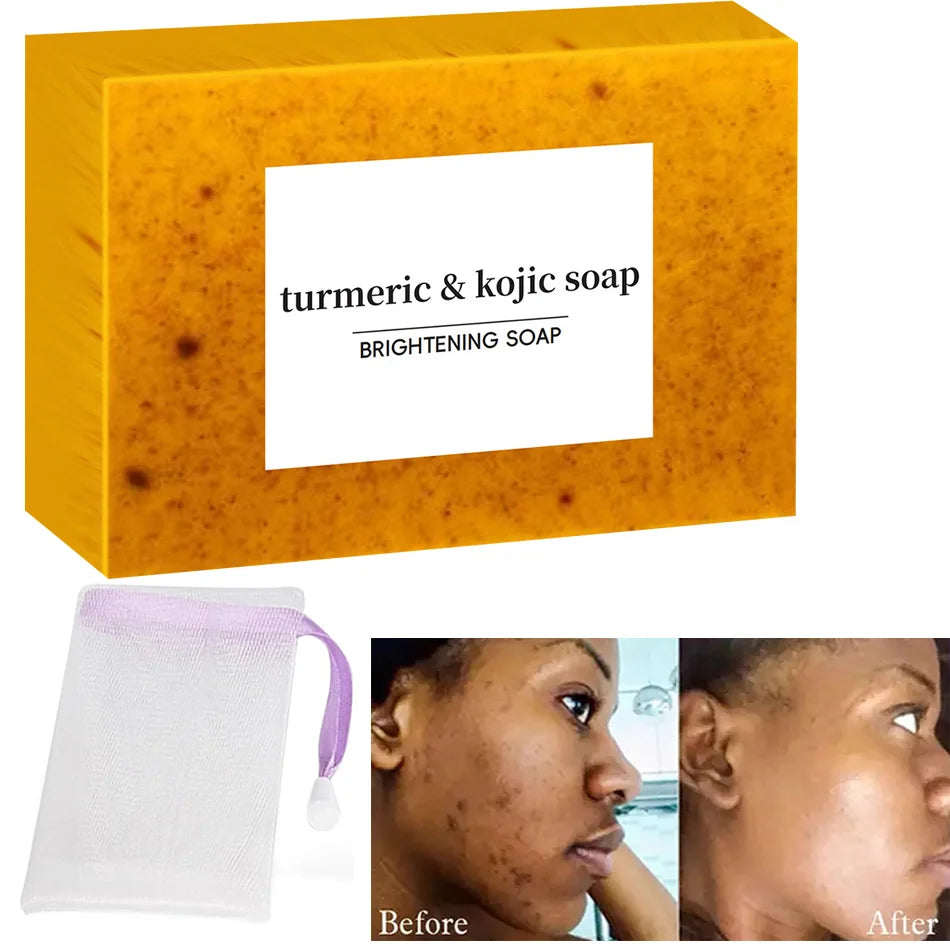 Turmeric Kojic Acid Glow Cleaning Soap for Dark Spot and Acne